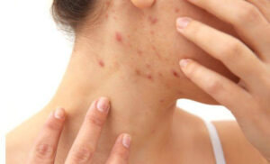 7 Dấu Hiệu Cảnh Báo Cơ Thể Tích Tụ Độc Tố Cần Thải Độc Ngay lập tức