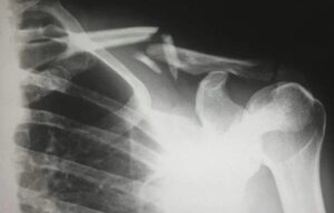 duy trì sức khỏe tổng thể của việc lạm dụng kem chống nắng.